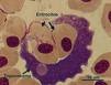 trypanosoma spaviná
